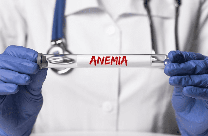 Anemia: o que é, como diagnosticar e tratar?